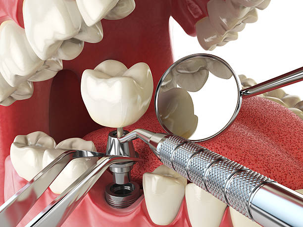Best Weekend Emergency Dentist in Lake Isabella, CA