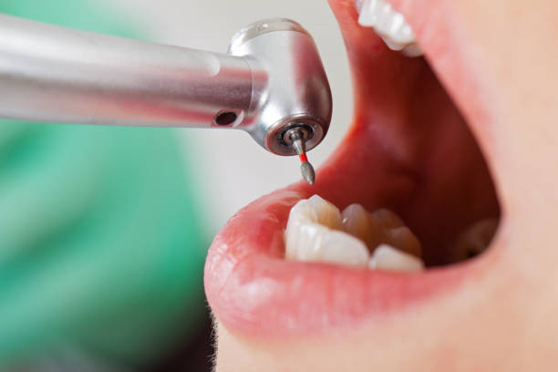 Best Orthodontic Emergency Dentist in Lake Isabella, CA
